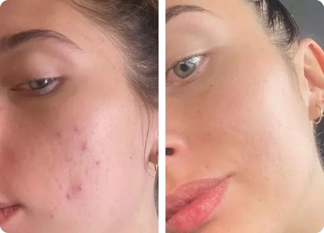 Elena U: Po 3 savaičių