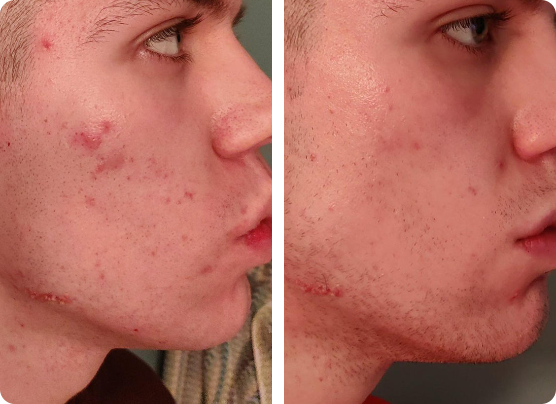 Monika T: Po 3 savaičių